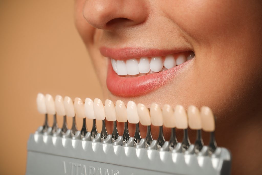 Smiling,Woman,With,Teeth,Color,Samples,On,Beige,Background,,Closeup.