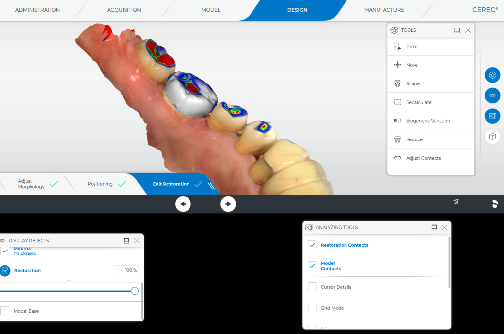 A computer screen displays a detailed 3D model of a tooth, showcasing its structure and features.