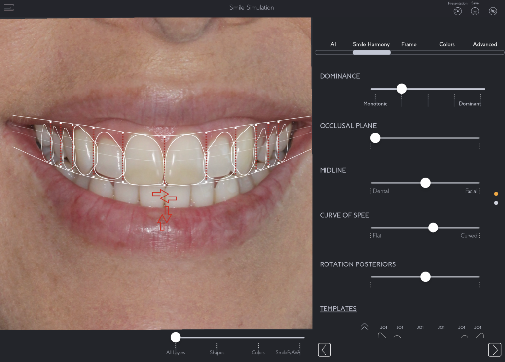 A computer screen displaying a bright smile with visible teeth, conveying a cheerful and positive expression.