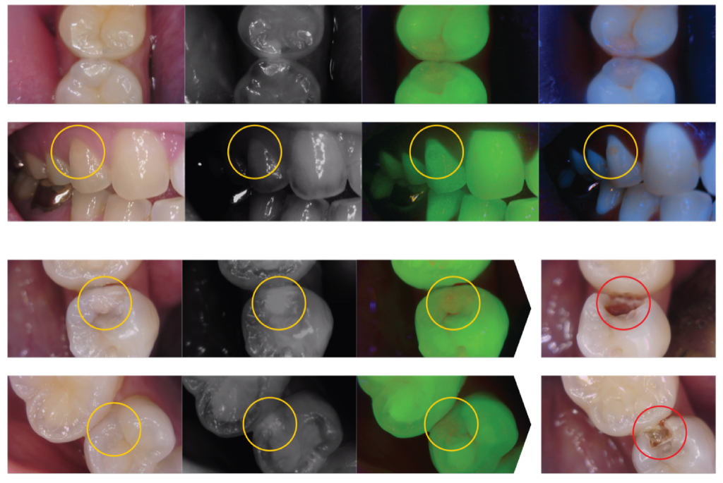 A collage of images displaying various types of teeth, including incisors, canines, premolars, and molars.