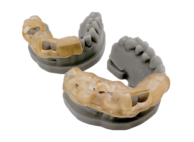Two dental implants with attached crowns, showcasing a realistic representation of dental restoration.
